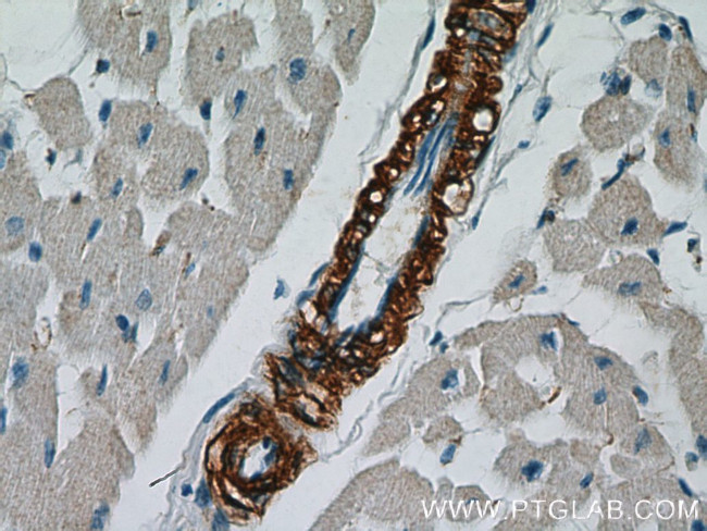 ACTA2/smooth muscle actin Antibody in Immunohistochemistry (Paraffin) (IHC (P))