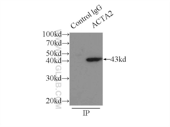 ACTA2/smooth muscle actin Antibody in Immunoprecipitation (IP)