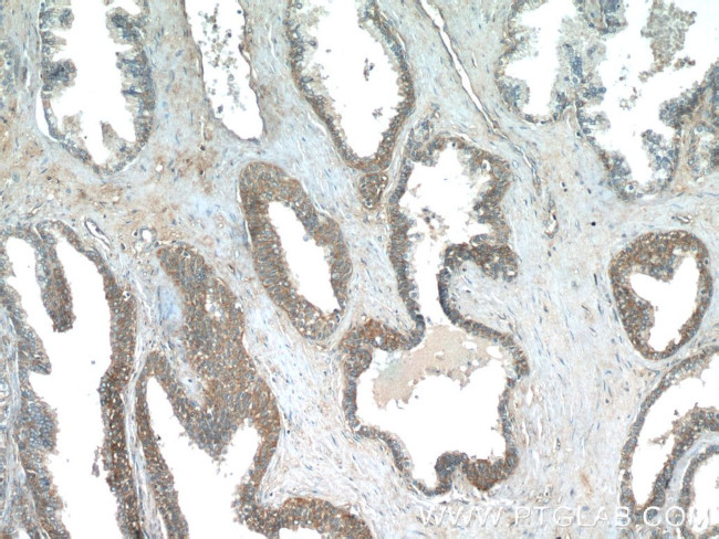 PASK Antibody in Immunohistochemistry (Paraffin) (IHC (P))