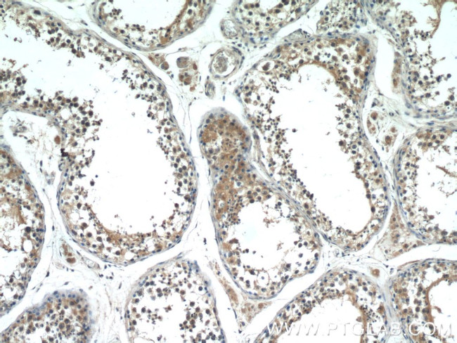 PASK Antibody in Immunohistochemistry (Paraffin) (IHC (P))