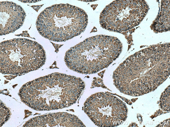 PASK Antibody in Immunohistochemistry (Paraffin) (IHC (P))