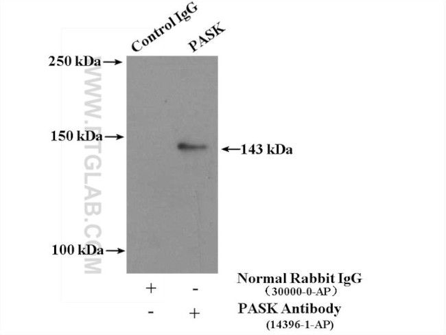 PASK Antibody in Immunoprecipitation (IP)