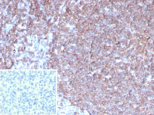 Granulocyte-Colony Stimulating Factor (G-CSF) Antibody in Immunohistochemistry (Paraffin) (IHC (P))