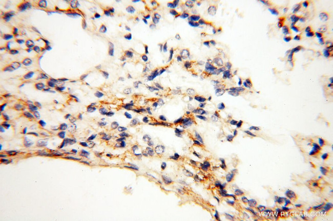 CLCNKA Antibody in Immunohistochemistry (Paraffin) (IHC (P))