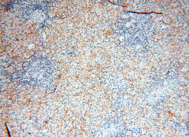 CLCNKA Antibody in Immunohistochemistry (Paraffin) (IHC (P))