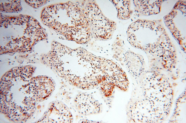 CLCNKA Antibody in Immunohistochemistry (Paraffin) (IHC (P))