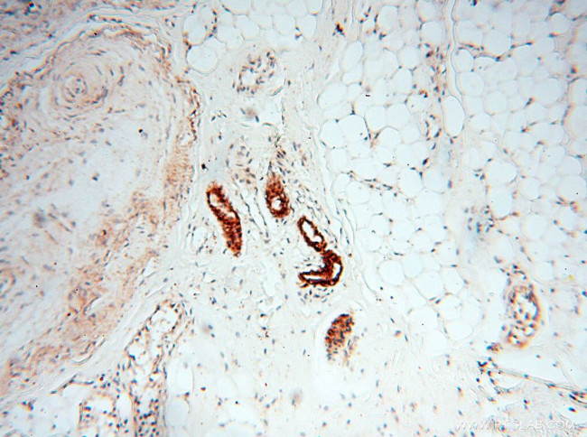 CLCNKA Antibody in Immunohistochemistry (Paraffin) (IHC (P))