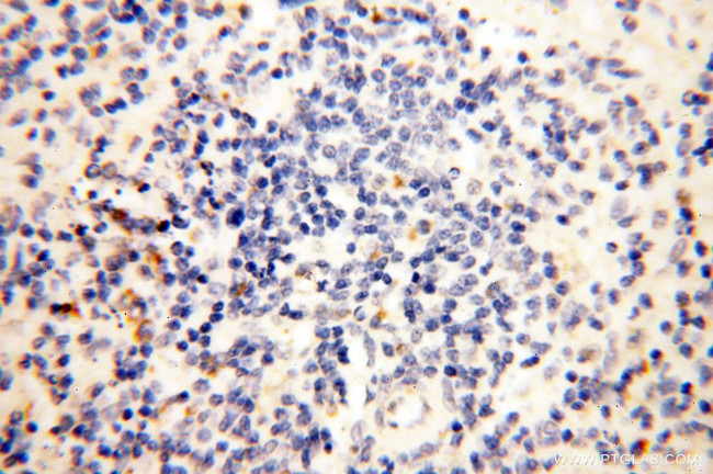 CLCNKA Antibody in Immunohistochemistry (Paraffin) (IHC (P))