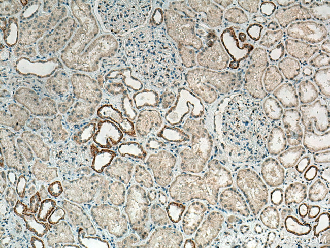 CLCNKA Antibody in Immunohistochemistry (Paraffin) (IHC (P))