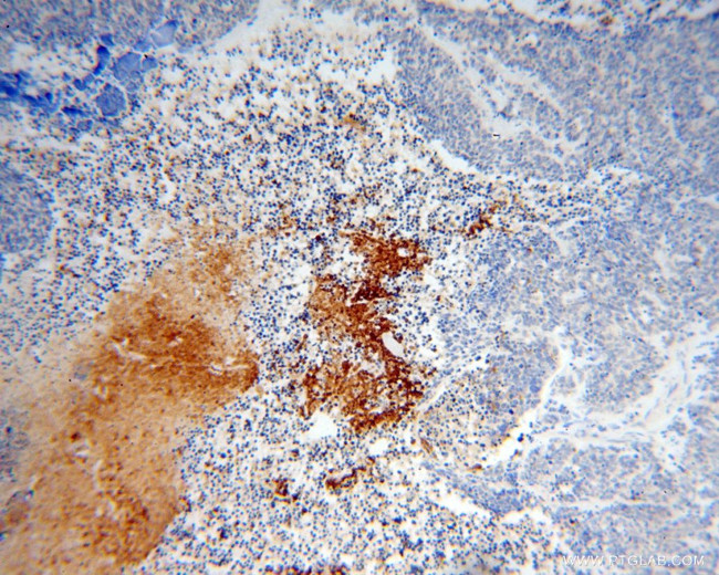 IPO11 Antibody in Immunohistochemistry (Paraffin) (IHC (P))