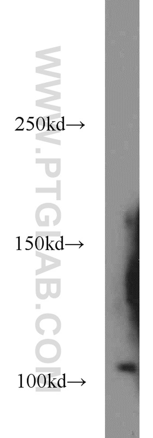 IPO11 Antibody in Western Blot (WB)