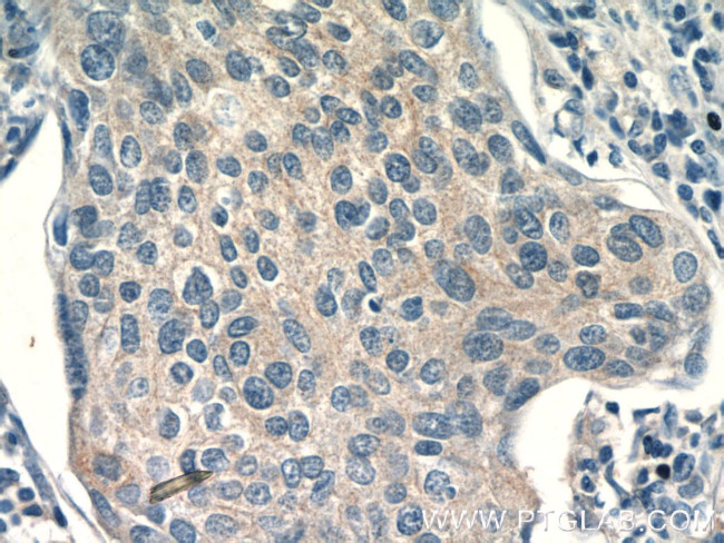 TRAF3IP1 Antibody in Immunohistochemistry (Paraffin) (IHC (P))