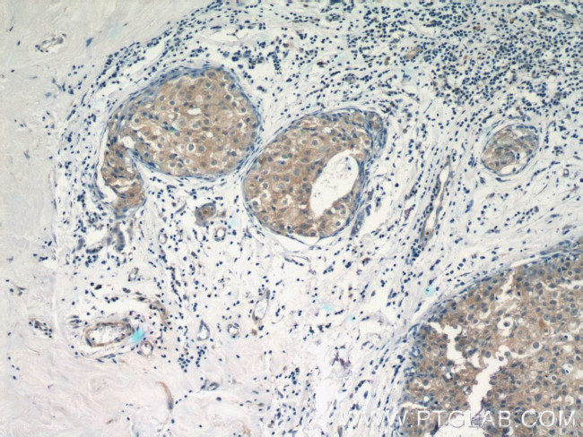 TRAF3IP1 Antibody in Immunohistochemistry (Paraffin) (IHC (P))