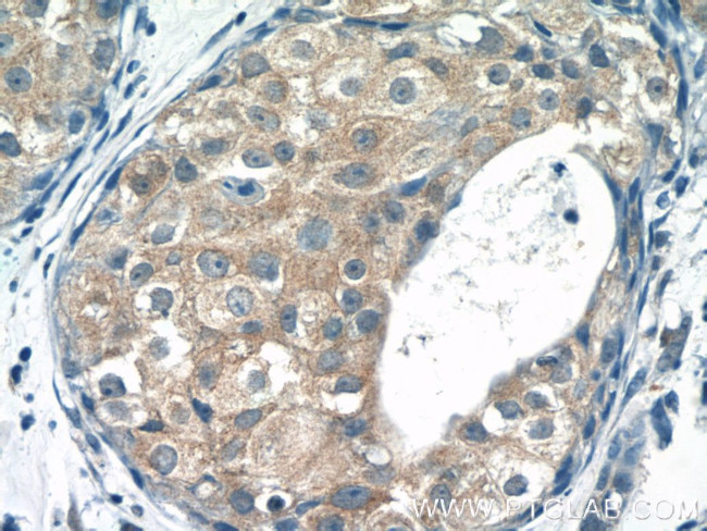 TRAF3IP1 Antibody in Immunohistochemistry (Paraffin) (IHC (P))