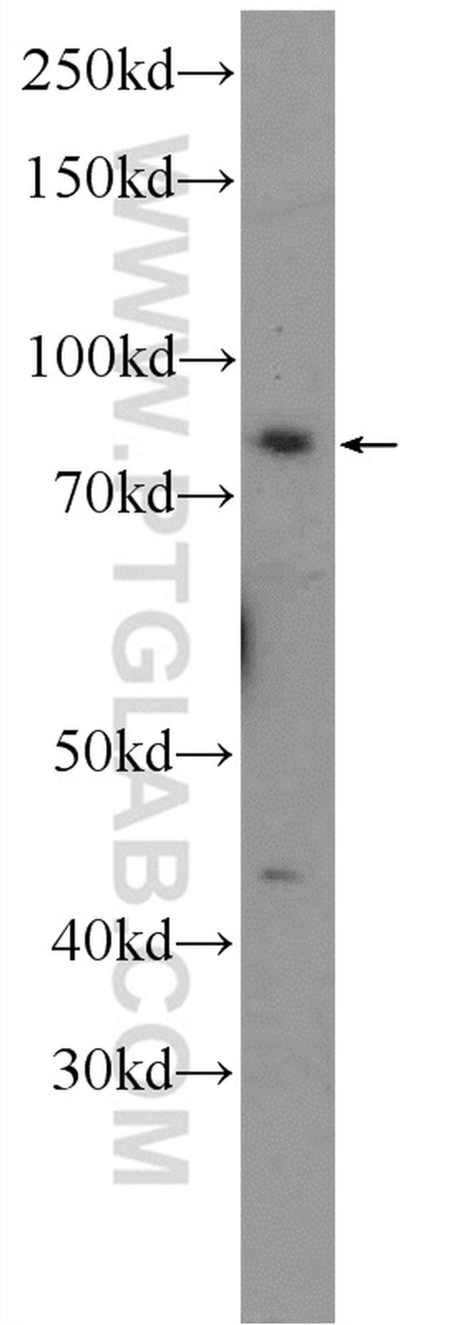 TRAF3IP1 Antibody in Western Blot (WB)