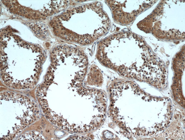 HE4 Antibody in Immunohistochemistry (Paraffin) (IHC (P))