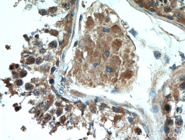 HE4 Antibody in Immunohistochemistry (Paraffin) (IHC (P))