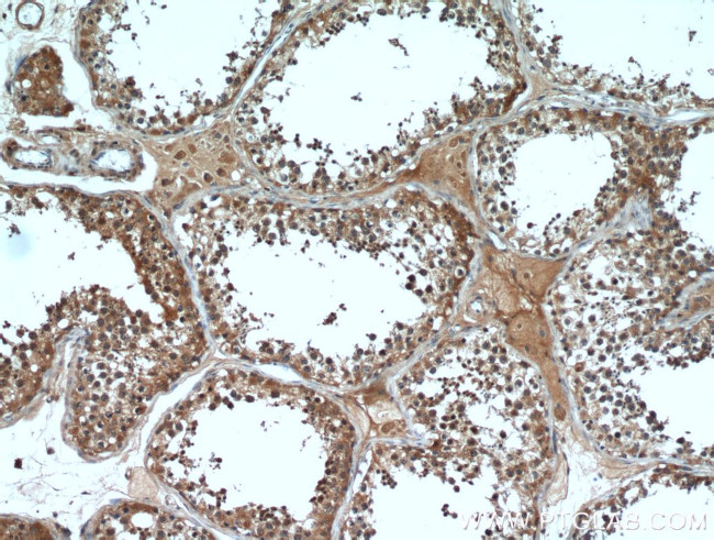 HE4 Antibody in Immunohistochemistry (Paraffin) (IHC (P))