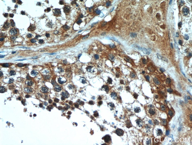 HE4 Antibody in Immunohistochemistry (Paraffin) (IHC (P))