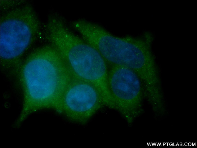 HE4 Antibody in Immunocytochemistry (ICC/IF)