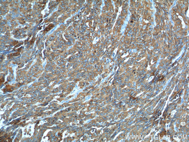 HE4 Antibody in Immunohistochemistry (Paraffin) (IHC (P))