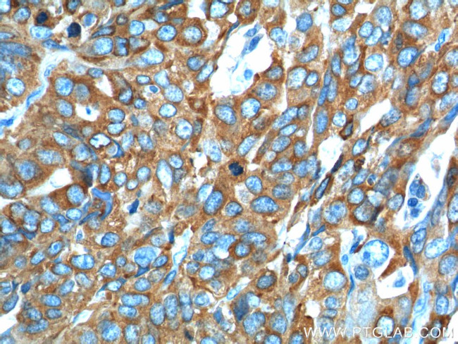 HE4 Antibody in Immunohistochemistry (Paraffin) (IHC (P))