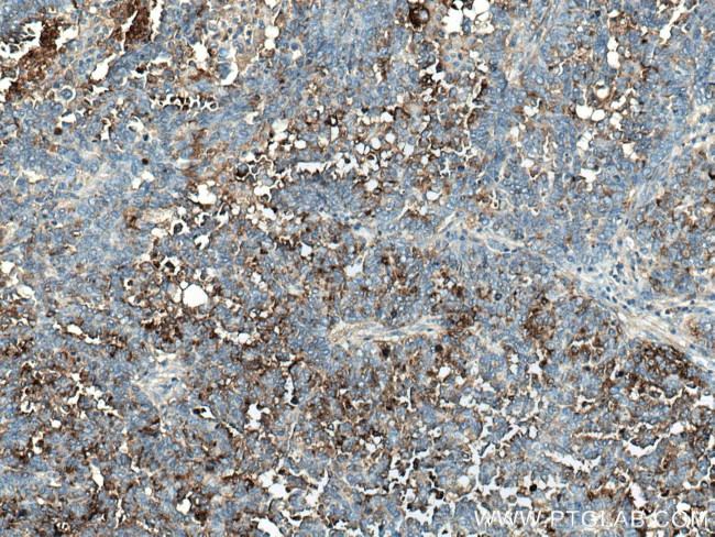 HE4 Antibody in Immunohistochemistry (Paraffin) (IHC (P))