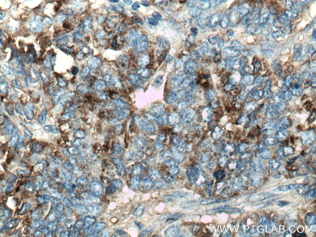 HE4 Antibody in Immunohistochemistry (Paraffin) (IHC (P))