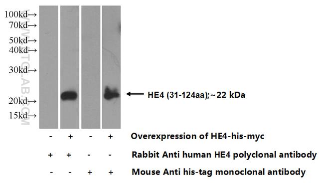 HE4 Antibody in Western Blot (WB)