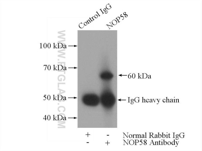 NOP58 Antibody in Immunoprecipitation (IP)