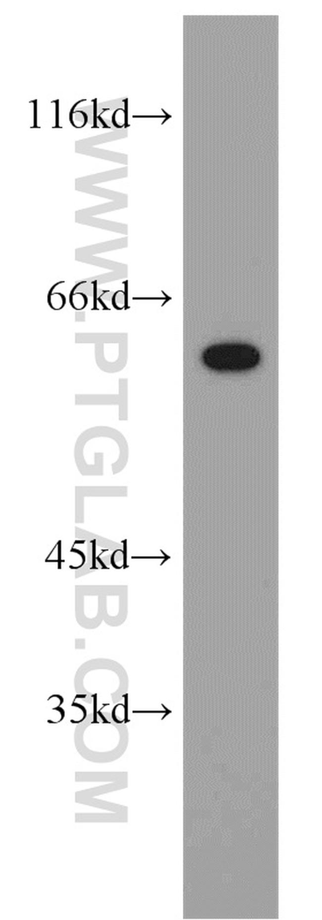 NOP58 Antibody in Western Blot (WB)