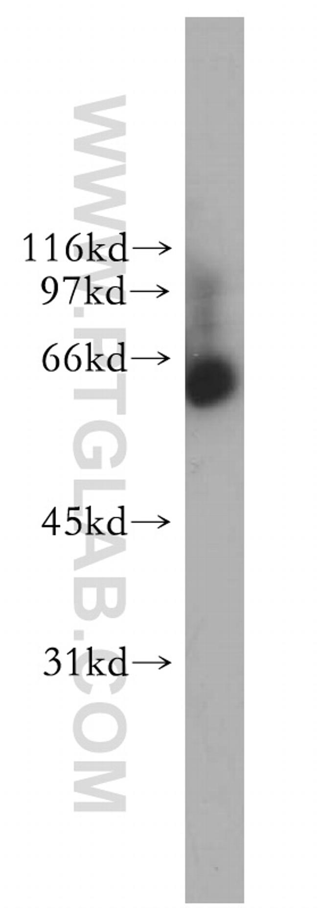 NOP58 Antibody in Western Blot (WB)
