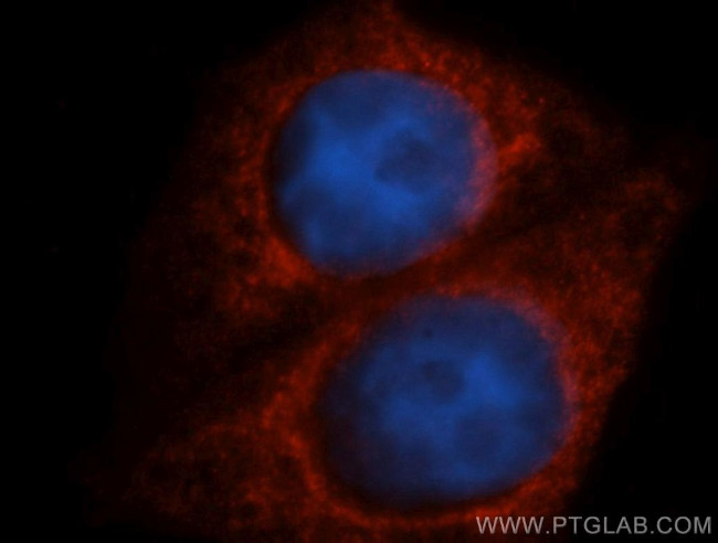 TAB2 Antibody in Immunocytochemistry (ICC/IF)