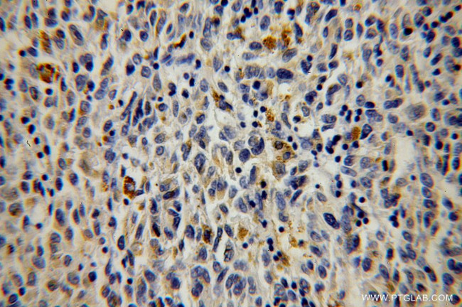 TAB2 Antibody in Immunohistochemistry (Paraffin) (IHC (P))