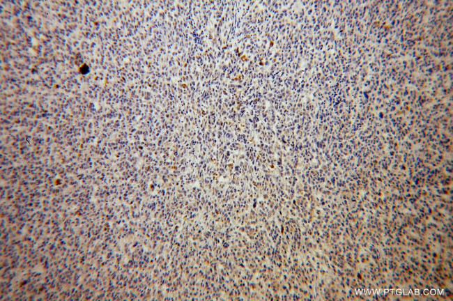 TAB2 Antibody in Immunohistochemistry (Paraffin) (IHC (P))