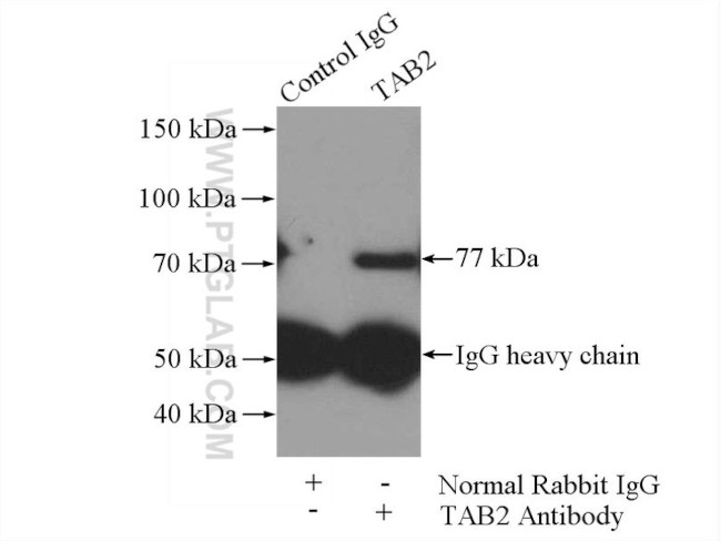 TAB2 Antibody in Immunoprecipitation (IP)