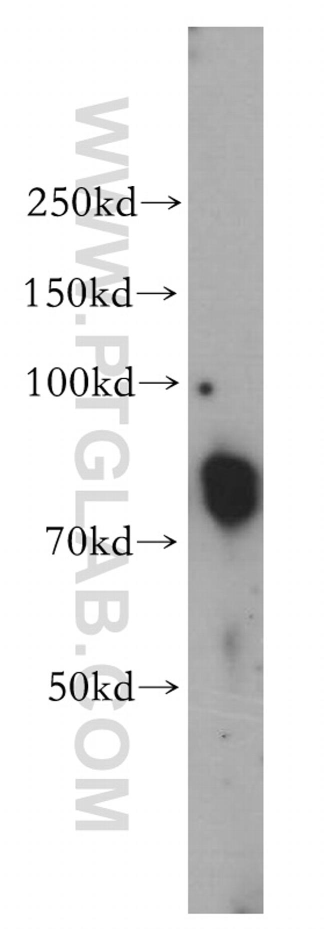 TAB2 Antibody in Western Blot (WB)