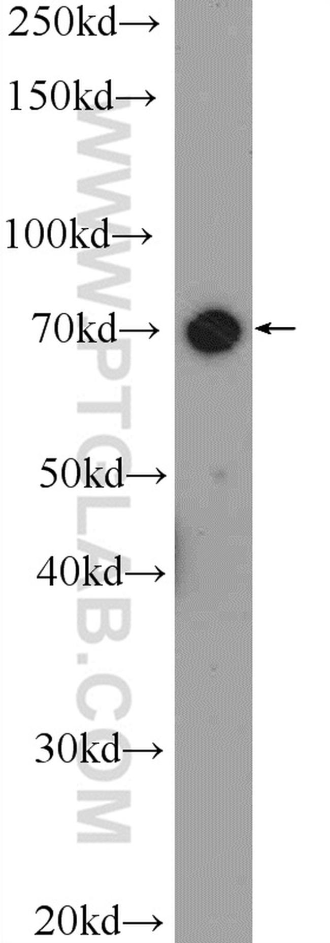 TAB2 Antibody in Western Blot (WB)