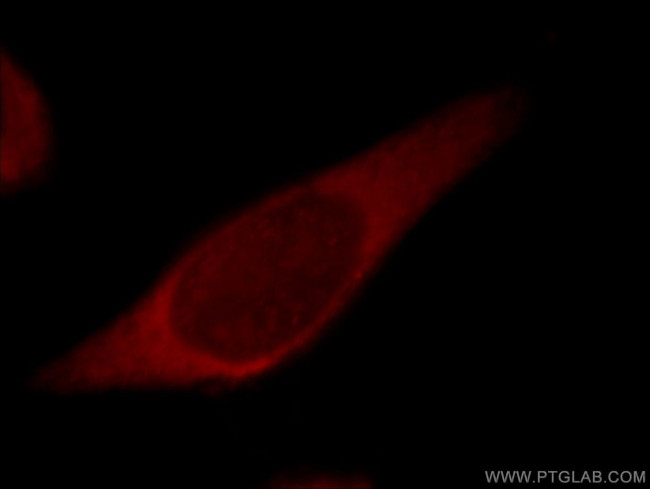 PIBF1 Antibody in Immunocytochemistry (ICC/IF)