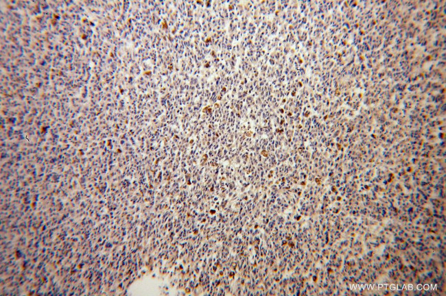 GALE Antibody in Immunohistochemistry (Paraffin) (IHC (P))