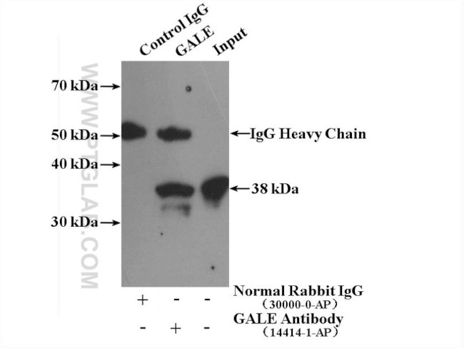 GALE Antibody in Immunoprecipitation (IP)