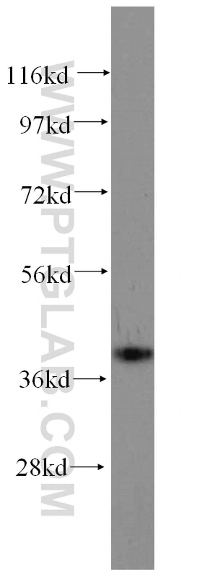 GALE Antibody in Western Blot (WB)