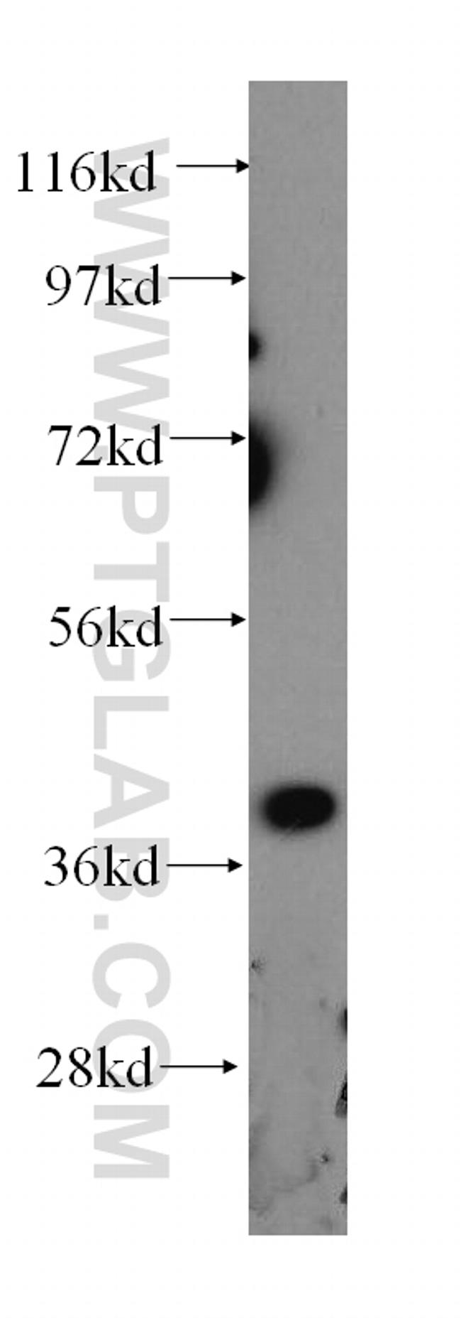 GALE Antibody in Western Blot (WB)