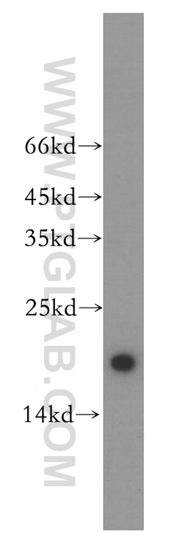 UBE2L3 Antibody in Western Blot (WB)