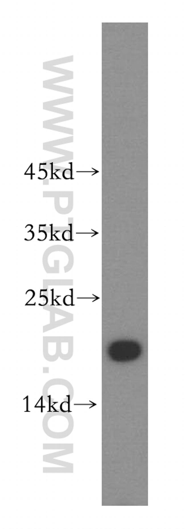 UBE2L3 Antibody in Western Blot (WB)