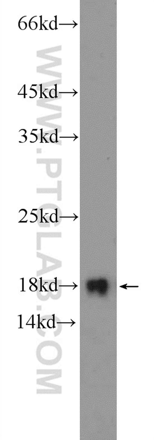 UBE2L3 Antibody in Western Blot (WB)