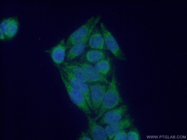 NDUFS6 Antibody in Immunocytochemistry (ICC/IF)