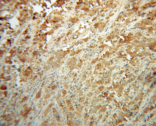 NDUFS6 Antibody in Immunohistochemistry (Paraffin) (IHC (P))