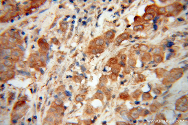 NDUFS6 Antibody in Immunohistochemistry (Paraffin) (IHC (P))