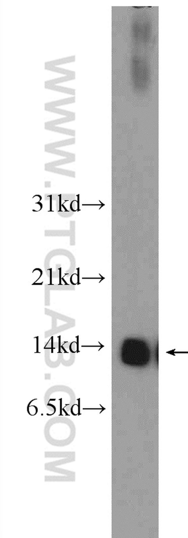 NDUFS6 Antibody in Western Blot (WB)